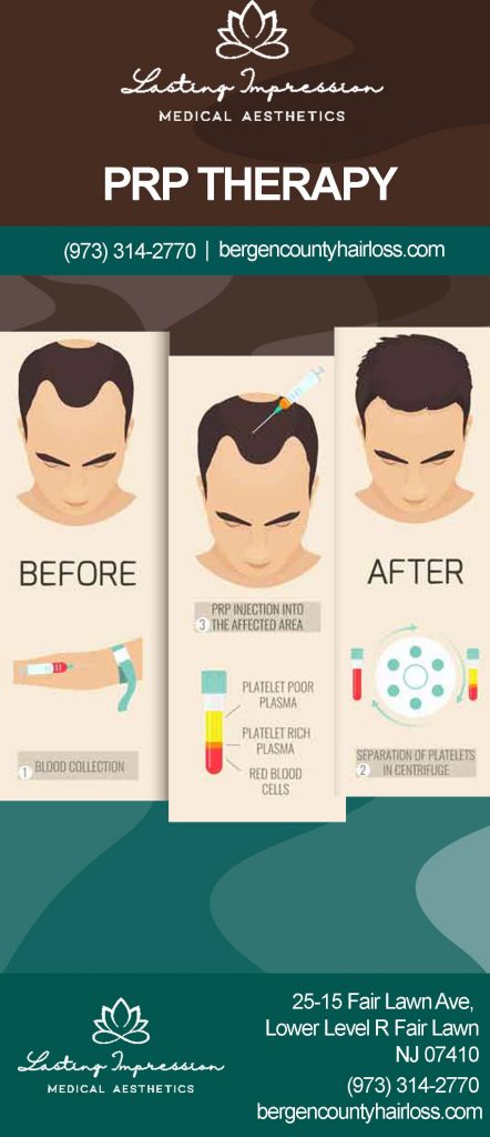 Hair Loss | Lasting Impression - PRP Infographic (Men)