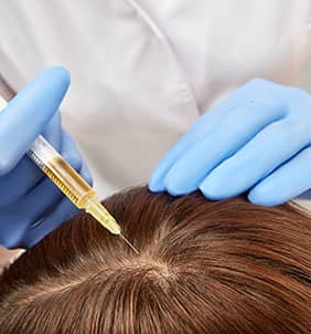 Hair Loss | Lasting Impression - Treatment