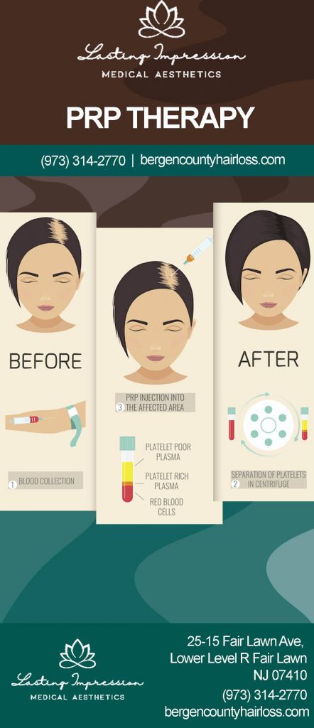 Hair Loss | Lasting Impression - PRP Infographic (Women)