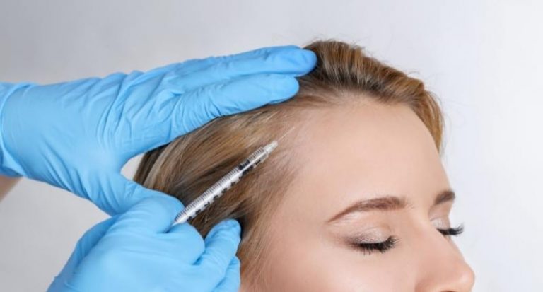 Hair Loss | Lasting Impression - PRP Therapy Effects on Hair