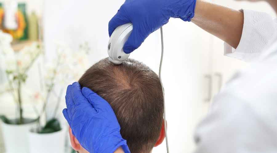hair doctor checking man's scalp | How to Look for a Hair Loss Specialist in Bergen County, NJ | Bergen County Hair Loss