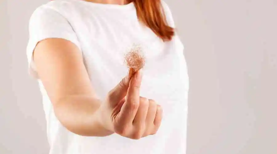 Women's Hair Loss: Three Factors to Consider | Bergen County Hair Loss