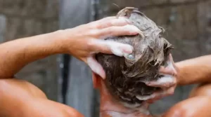 Does Ketoconazole Hair Loss Shampoo Work? | Bergen County Hair Loss