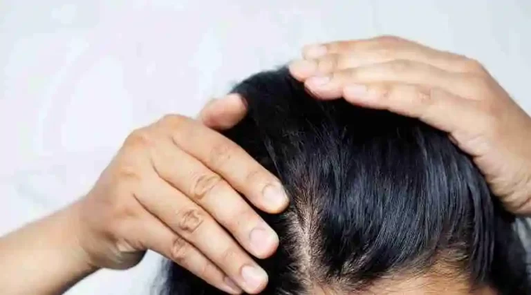 What is alopecia, its several varieties, what causes it, and how can it be treated?