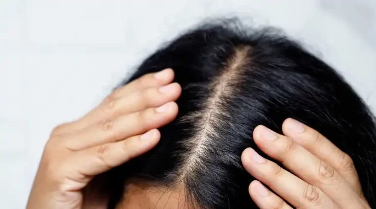 Why Am I Losing My Hair? | Bergen County Hair Loss Clinic