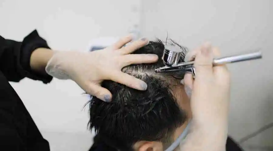 TREATMENTS FOR HAIR LOSS - A MIRACLE OR A MONEY SCAM
