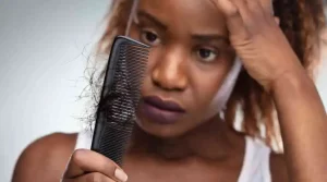 Psychology of Hair Loss Explained