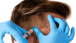 PRP Hair Restoration