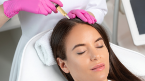 Stem Cell Therapy for Hair Loss A Look at This Emerging Treatment