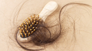 Understanding Hair Loss