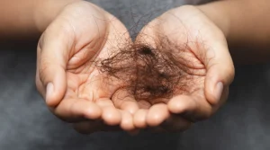 Non-Surgical Solutions for Pattern Baldness in Bergen County