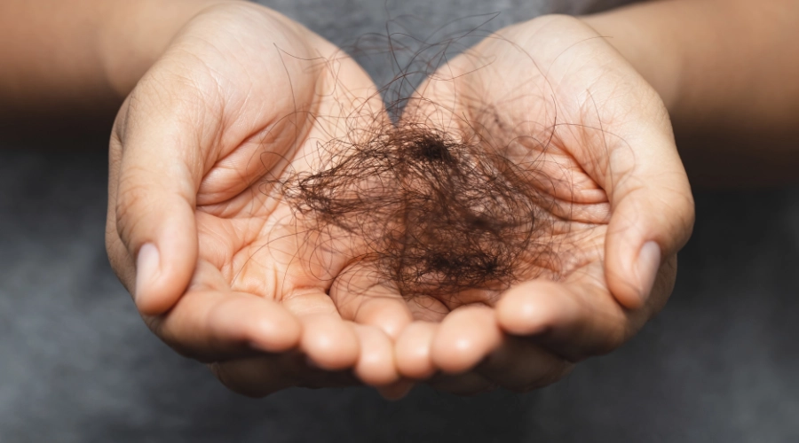 Non-Surgical Solutions for Pattern Baldness in Bergen County